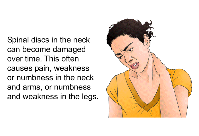 Spinal discs in the neck can become damaged over time. This often causes pain, weakness or numbness in the neck and arms, or numbness and weakness in the legs.