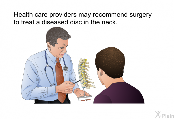 Health care providers may recommend surgery to treat a diseased disc in the neck.
