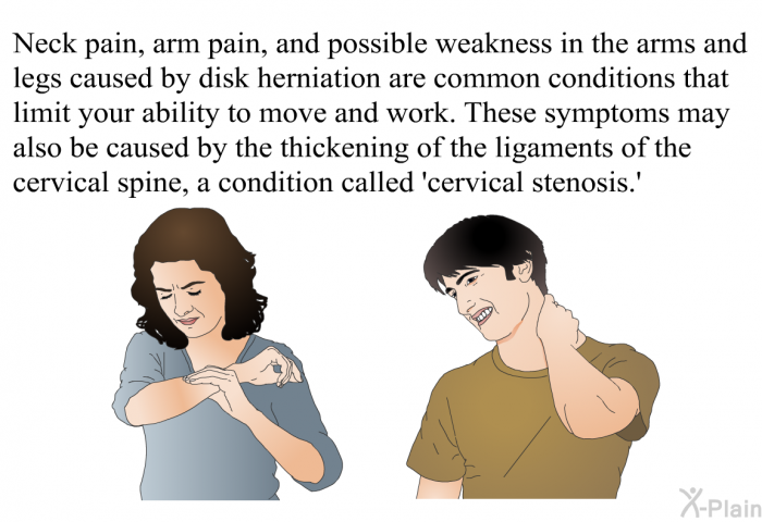 Neck pain, arm pain, and possible weakness in the arms and legs caused by disk herniation are common conditions that limit your ability to move and work. These symptoms may also be caused by the thickening of the ligaments of the cervical spine, a condition called ‘cervical stenosis.’