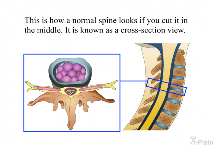 This is how a normal spine looks if you cut it in the middle. It is known as a cross-section view.