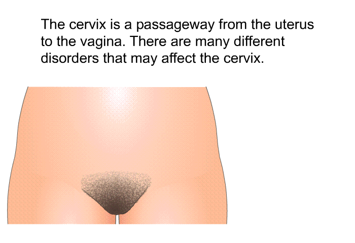 The cervix is a passageway from the uterus to the vagina. There are many different disorders that may affect the cervix.