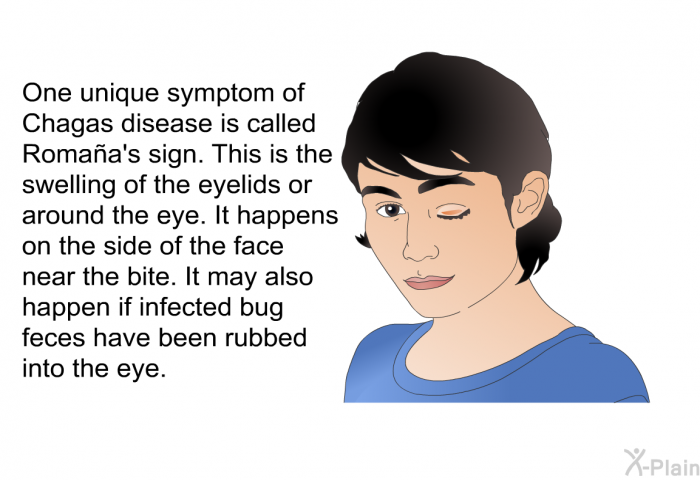 One unique symptom of Chagas disease is called Romaa's sign. This is the swelling of the eyelids or around the eye. It happens on the side of the face near the bite. It may also happen if infected bug feces have been rubbed into the eye.