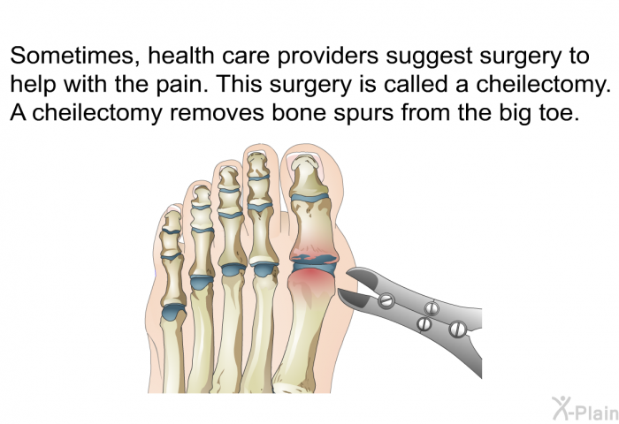 Sometimes, health care providers suggest surgery to help with the pain. This surgery is called a cheilectomy. A cheilectomy removes bone spurs from the big toe.