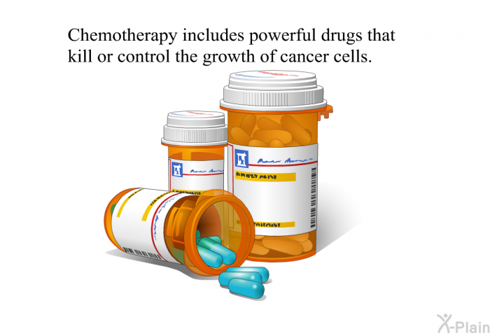 Chemotherapy includes powerful drugs that kill or control the growth of cancer cells.