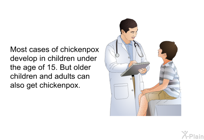 Most cases of chickenpox develop in children under the age of 15. But older children and adults can also get chickenpox.
