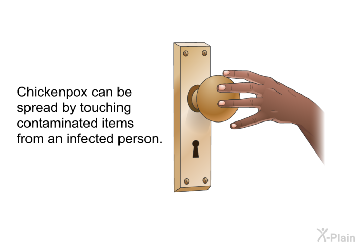 Chickenpox can be spread by touching contaminated items from an infected person.