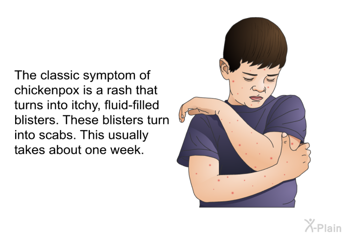 The classic symptom of chickenpox is a rash that turns into itchy, fluid-filled blisters. These blisters turn into scabs. This usually takes about one week.