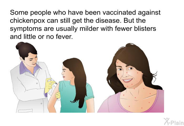 Some people who have been vaccinated against chickenpox can still get the disease. But the symptoms are usually milder with fewer blisters and little or no fever.