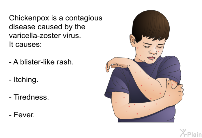 Chickenpox is a contagious disease caused by the varicella-zoster virus. It causes:  A blister-like rash. Itching. Tiredness. Fever.