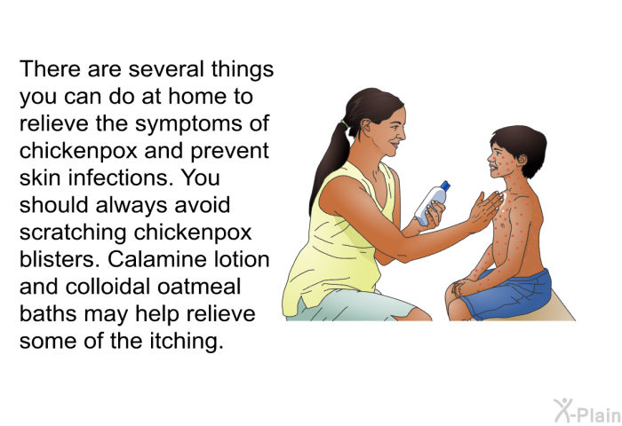 There are several things you can do at home to relieve the symptoms of chickenpox and prevent skin infections. You should always avoid scratching chickenpox blisters. Calamine lotion and colloidal oatmeal baths may help relieve some of the itching.
