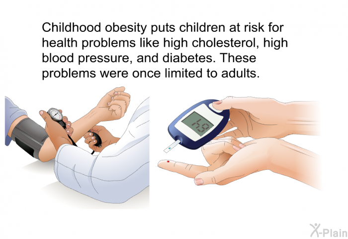 Childhood obesity puts children at risk for health problems like high cholesterol, high blood pressure, and diabetes. These problems were once limited to adults.