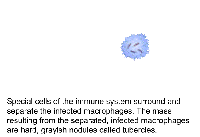 Special cells of the immune system surround and separate the infected macrophages. The mass resulting from the separated, infected macrophages are hard, grayish nodules called tubercles.