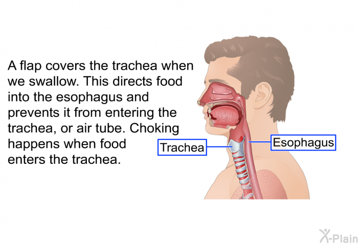 A flap covers the trachea when we swallow. This directs food into the esophagus and prevents it from entering the trachea, or air tube. Choking happens when food enters the trachea.