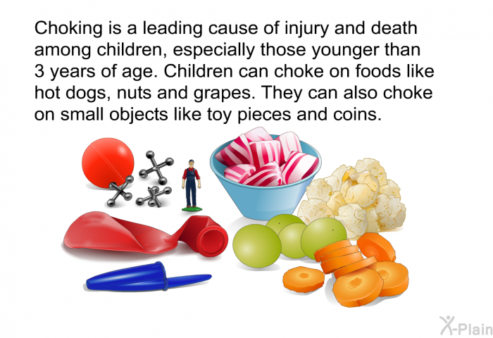Choking is a leading cause of injury and death among children, especially those younger than 3 years of age. Children can choke on foods like hot dogs, nuts and grapes. They can also choke on small objects like toy pieces and coins.
