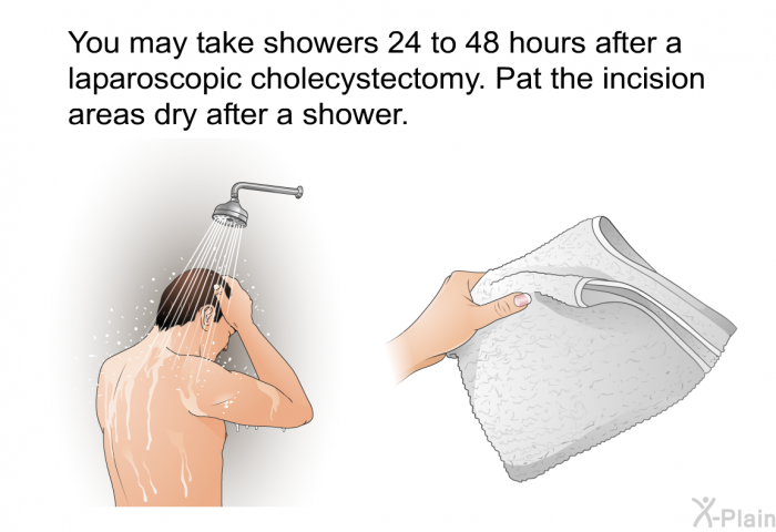 You may take showers 24 to 48 hours after a laparoscopic cholecystectomy. Pat the incision areas dry after a shower.