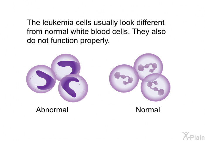 The leukemia cells usually look different from normal white blood cells. They also do not function properly.