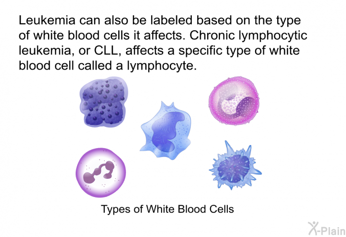Leukemia can also be labeled based on the type of white blood cells it affects. Chronic lymphocytic leukemia, or CLL, affects a specific type of white blood cell called a lymphocyte.