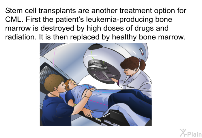Stem cell transplants are another treatment option for CML. First the patient's leukemia-producing bone marrow is destroyed by high doses of drugs and radiation. It is then replaced by healthy bone marrow.