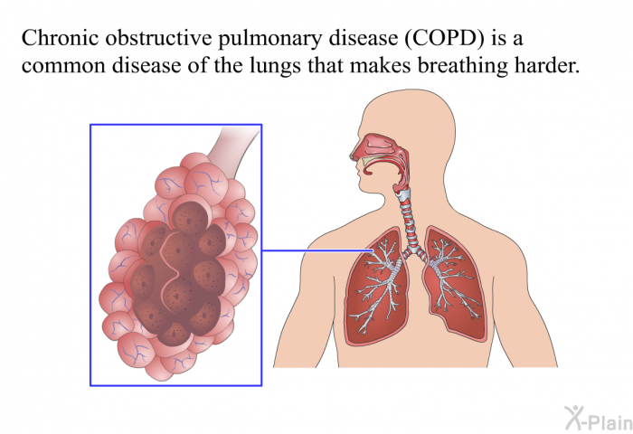 Chronic obstructive pulmonary disease (COPD) is a common disease of the lungs that makes breathing harder.