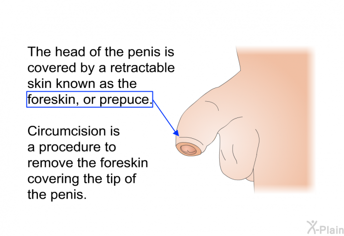 The head of the penis is covered by a retractable skin known as the foreskin, or prepuce. Circumcision is a procedure to remove the foreskin covering the tip of the penis.