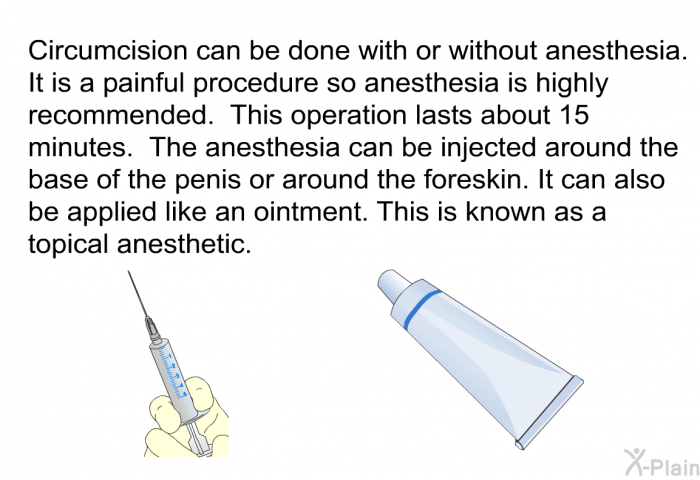 Circumcision can be done with or without anesthesia. It is a painful procedure so anesthesia is highly recommended. This operation lasts about 15 minutes. The anesthesia can be injected around the base of the penis or around the foreskin. It can also be applied like an ointment. This is known as a topical anesthetic.