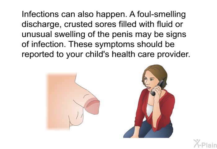 Infections can also happen. A foul-smelling discharge, crusted sores filled with fluid or unusual swelling of the penis may be signs of infection. These symptoms should be reported to your child's health care provider.