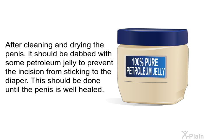 After cleaning and drying the penis, it should be dabbed with some petroleum jelly to prevent the incision from sticking to the diaper. This should be done until the penis is well healed.