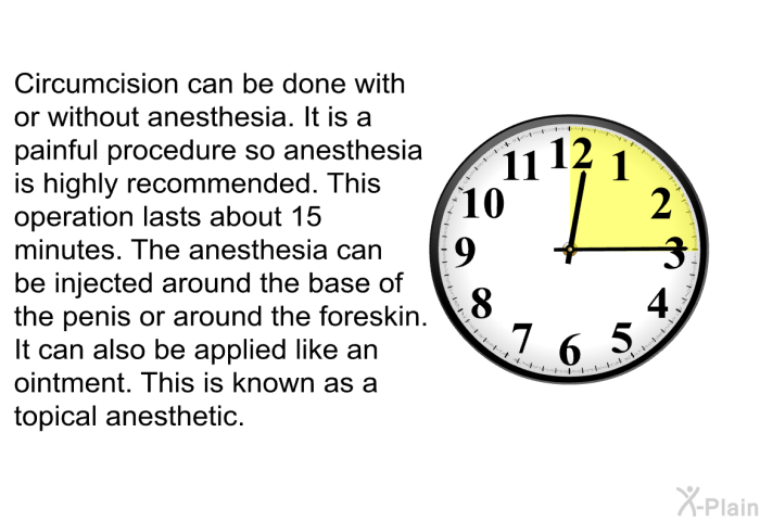 Circumcision can be done with or without anesthesia. It is a painful procedure so anesthesia is highly recommended. This operation lasts about 15 minutes. The anesthesia can be injected around the base of the penis or around the foreskin. It can also be applied like an ointment. This is known as a topical anesthetic.