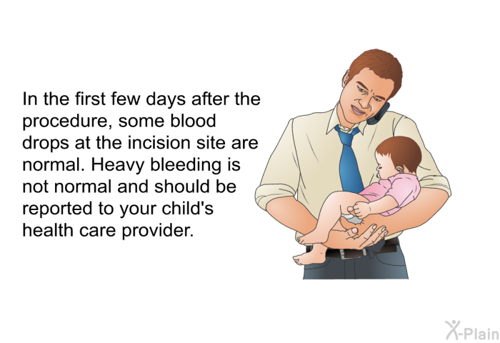 In the first few days after the procedure, some blood drops at the incision site are normal. Heavy bleeding is not normal and should be reported to your child's health care provider.