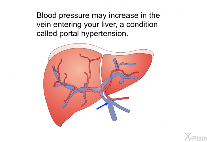 Blood pressure may increase in the vein entering your liver, a condition called portal hypertension.