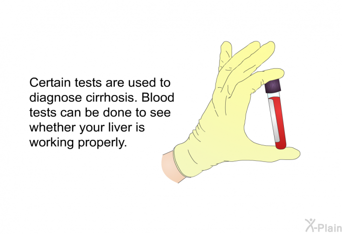 Certain tests are used to diagnose cirrhosis. Blood tests can be done to see whether your liver is working properly.