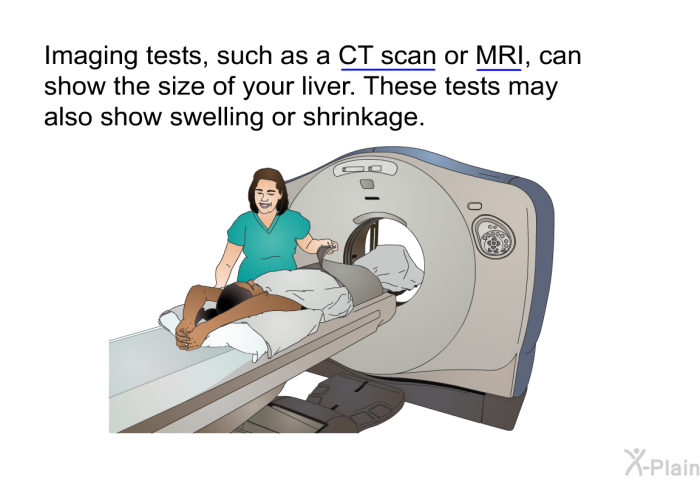 Imaging tests, such as a CT scan or MRI, can show the size of your liver. These tests may also show swelling or shrinkage.