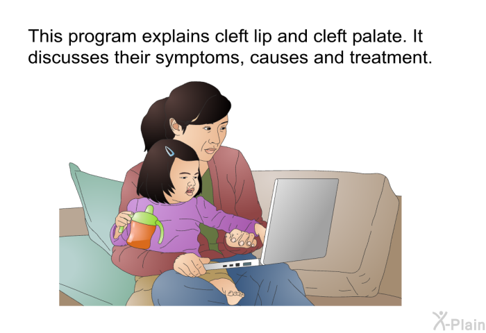 This health information explains cleft lip and cleft palate. It discusses their symptoms, causes and treatment.