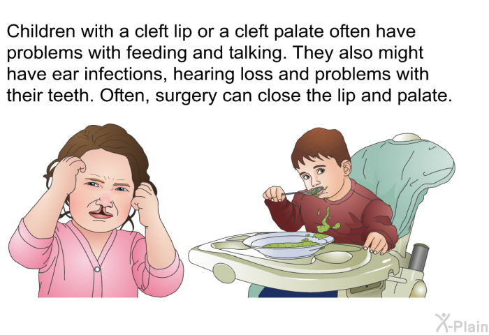 Children with a cleft lip or a cleft palate often have problems with feeding and talking. They also might have ear infections, hearing loss and problems with their teeth. Often, surgery can close the lip and palate.