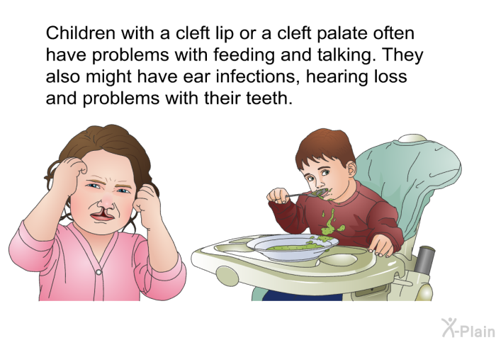 Children with a cleft lip or a cleft palate often have problems with feeding and talking. They also might have ear infections, hearing loss and problems with their teeth.