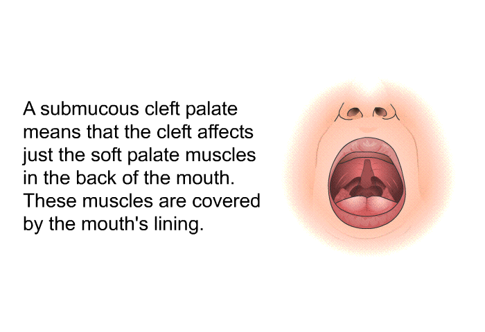 A submucous cleft palate means that the cleft affects just the soft palate muscles in the back of the mouth. These muscles are covered by the mouth's lining.