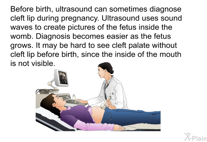 Before birth, ultrasound can sometimes diagnose cleft lip during pregnancy. Ultrasound uses sound waves to create pictures of the fetus inside the womb. Diagnosis becomes easier as the fetus grows. It may be hard to see cleft palate without cleft lip before birth, since the inside of the mouth is not visible.