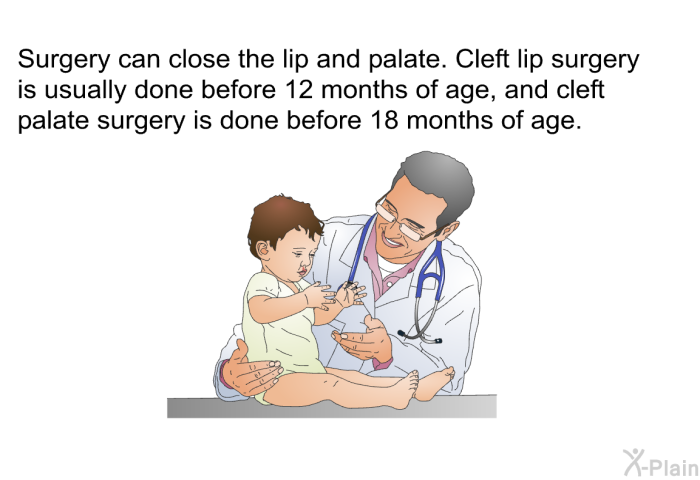 Surgery can close the lip and palate. Cleft lip surgery is usually done before 12 months of age, and cleft palate surgery is done before 18 months of age.