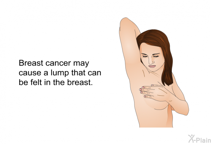 Breast cancer may cause a lump that can be felt in the breast.