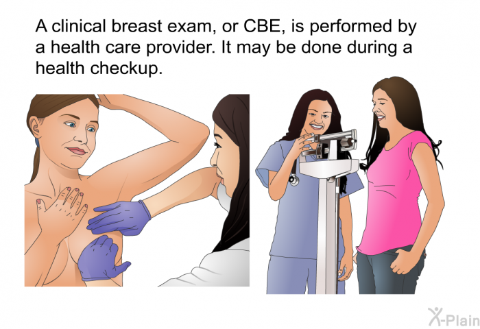 A clinical breast exam, or CBE, is performed by a health care provider. It may be done during a health checkup.