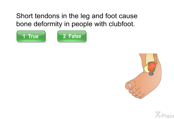 Short tendons in the leg and foot cause bone deformity in people with clubfoot.