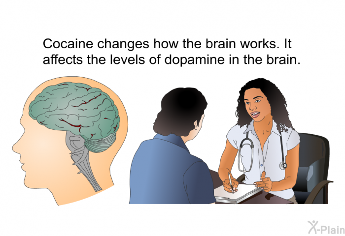 Cocaine changes how the brain works. It affects the levels of dopamine in the brain.