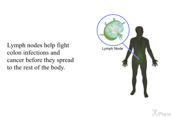 Lymph nodes help fight colon infections and cancer before they spread to the rest of the body.