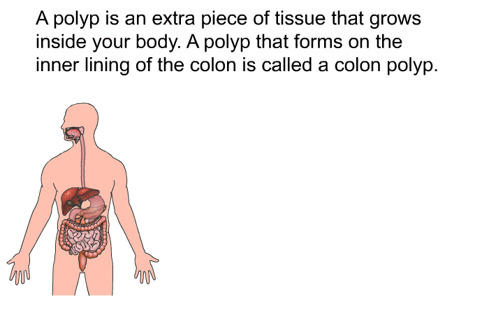 A polyp is an extra piece of tissue that grows inside your body. A polyp that forms on the inner lining of the colon is called a colon polyp.