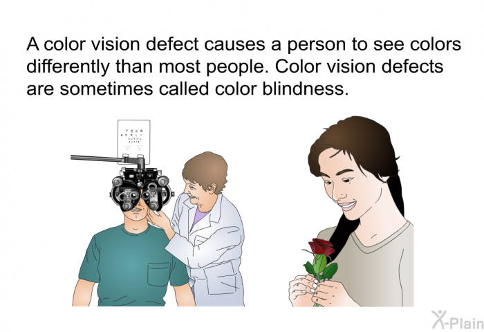 A color vision defect causes a person to see colors differently than most people. Color vision defects are sometimes called color blindness.