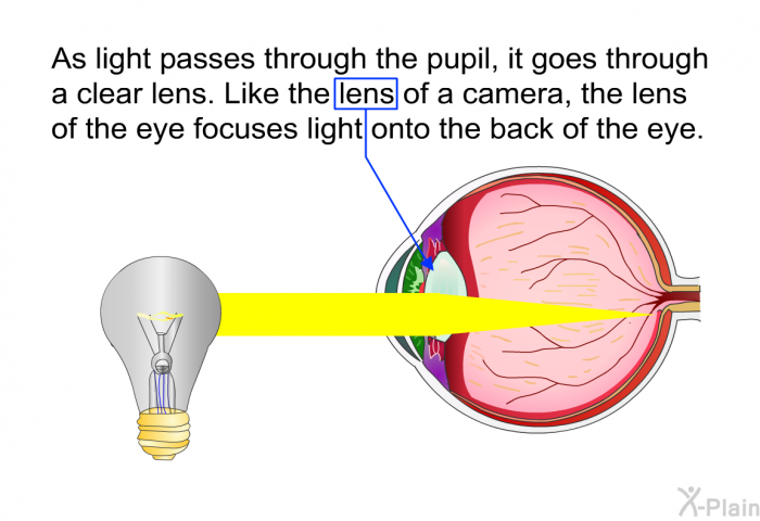 As light passes through the pupil, it goes through a clear lens. Like the lens of a camera, the lens of the eye focuses light onto the back of the eye.