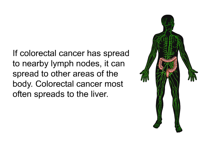 If colorectal cancer has spread to nearby lymph nodes, it can spread to other areas of the body. Colorectal cancer most often spreads to the liver.