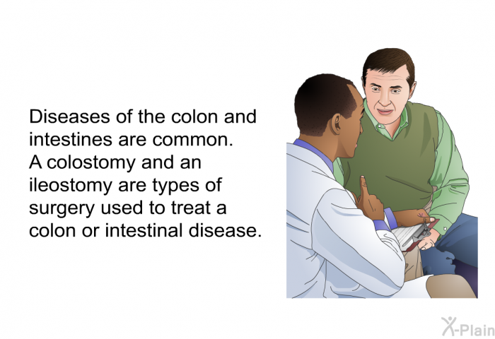 Diseases of the colon and intestines are common. A colostomy and an ileostomy are types of surgery used to treat a colon or intestinal disease.