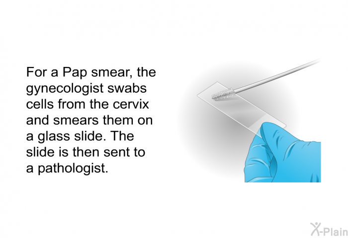 For a Pap smear, the gynecologist swabs cells from the cervix and smears them on a glass slide. The slide is then sent to a pathologist.