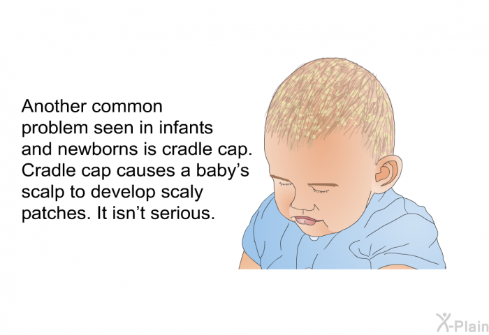 Another common problem seen in infants and newborns is cradle cap. Cradle cap causes a baby's scalp to develop scaly patches. It isn't serious.